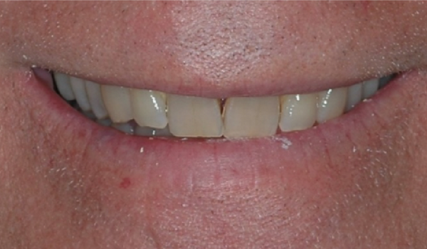 tulsa cosmetic dentistry