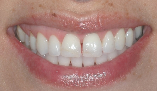 tulsa cosmetic dentistry
